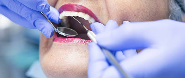 Best Emergency Treatment for Dental Infections or Abscesses in Doylestown, OH